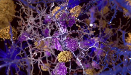 NMN Demonstrates Potential Efficacy in a Glaucoma Model