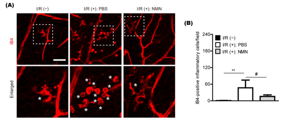 NMN prevents the buildup of inflammatory cells in the retina NMN prevents the buildup of inflammatory cells in the retina