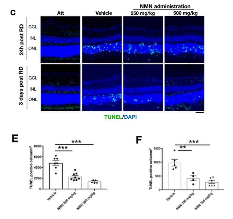 Administering mice with NMN significantly reduced photoreceptor cell death after retinal detachment Administering mice with NMN significantly reduced photoreceptor cell death after retinal detachment