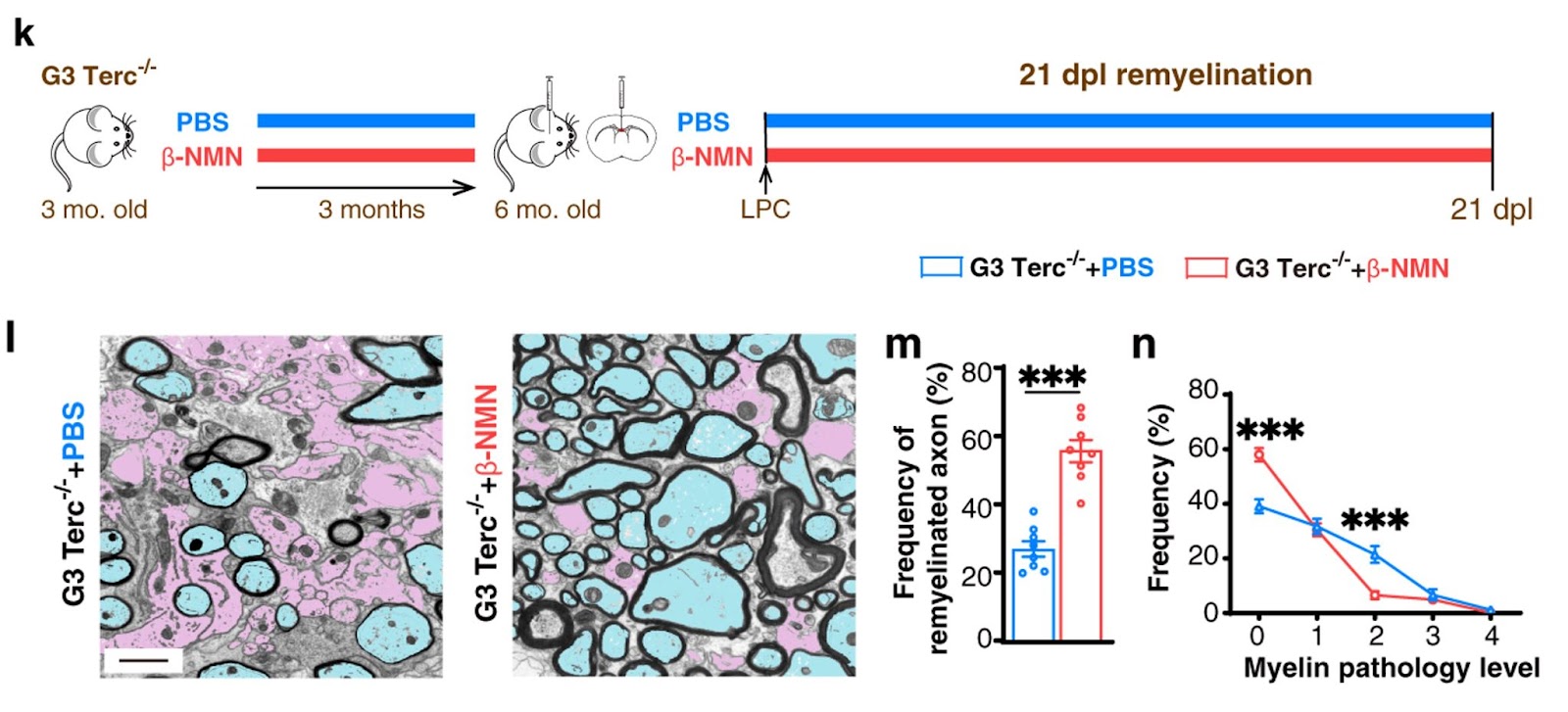 NMN enhances remyelination in aged mice. NMN enhances remyelination in aged mice.