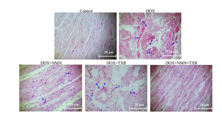 NMN and troxerutin treatment protects heart tissue against doxorubicin treatment NMN and troxerutin treatment protects heart tissue against doxorubicin treatment