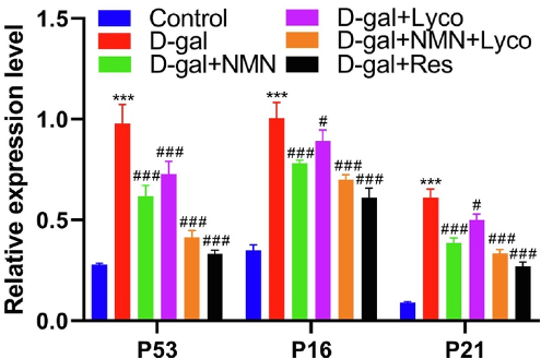 NMN, Lycopene, and Resveratrol Reduce Brain Senescence. NMN, Lycopene, and Resveratrol Reduce Brain Senescence.