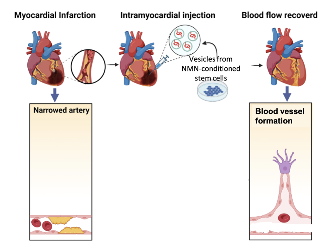 1686792123484466.png NMN Assists Stem Cell Exosomes: Bringing New Hope for Heart Repair