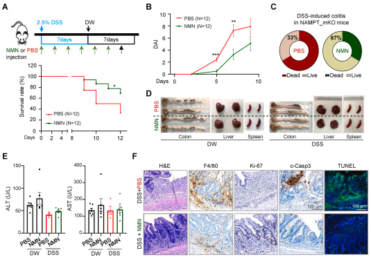 NMN supplementation protects mice from inflammatory bowel disease NMN supplementation protects mice from inflammatory bowel disease