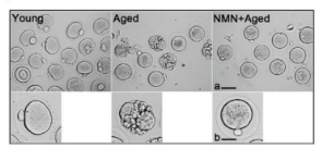 NMN + Aged NMN + Aged