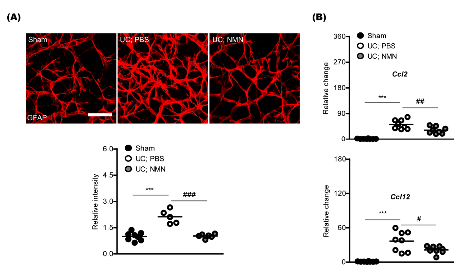 Figure: NMN improves retinal gliosis and inflammation Figure: NMN improves retinal gliosis and inflammation
