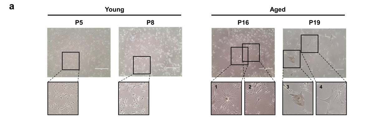 Comparison of morphology of young and aged melanocytes Comparison of morphology of young and aged melanocytes